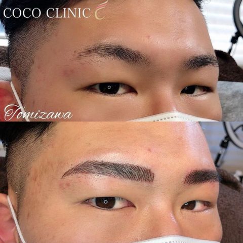 症例169 担当 冨澤さん メンズ眉 港区 麻布十番のアートメイク ココクリニック